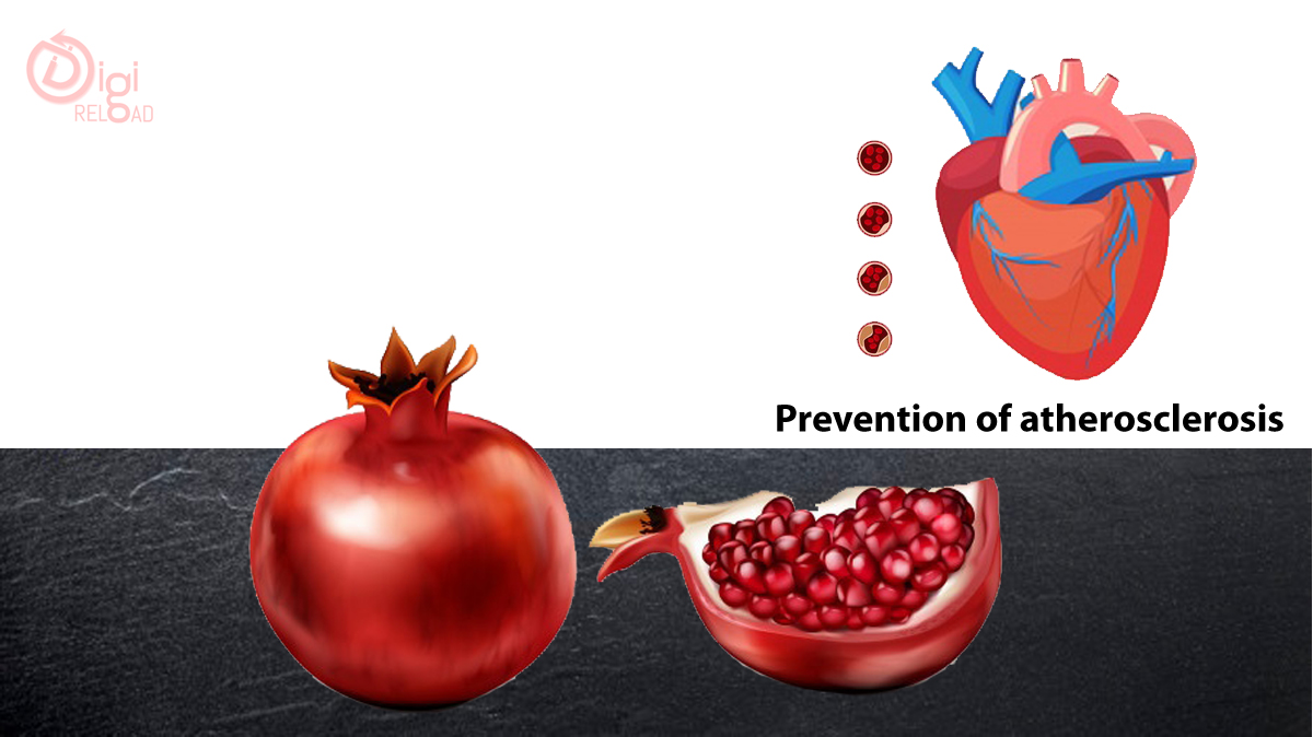 Prevention Of Atherosclerosis